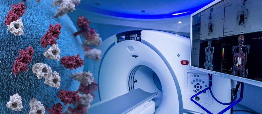 How Nuclear Medicine Is Transforming Heart Disease Diagnosis